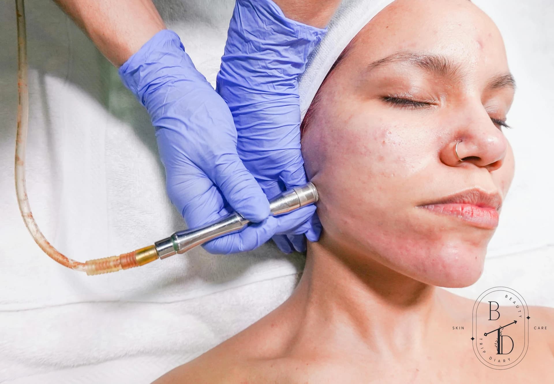 How to Properly Clear Blackheads and Whiteheads in Taiwan's Climate