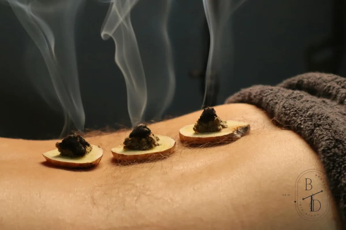 Traditional pure aged mugwort moxibustion warming ritual promoting facial microcirculation in Bade