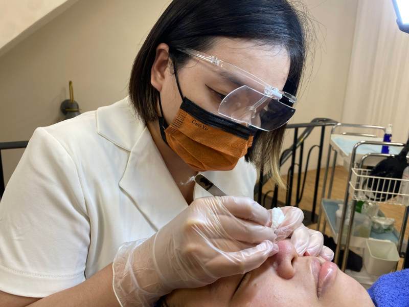 Skincareprofessional Black Head Removal Treatment